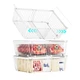 ANJUBAN Large Freezer Organizer Bins Upgraded Leak-Proof Bottom 3 Pack Expandabl